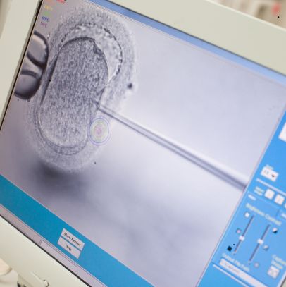 Male Fertility Diagnostics